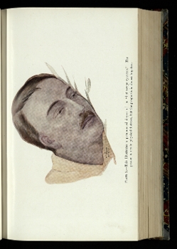 Illustration of a man with influenza